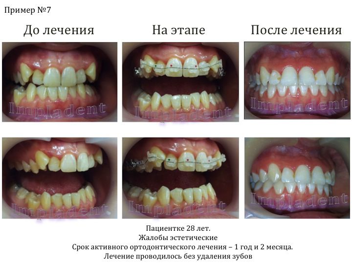 Фото После Список